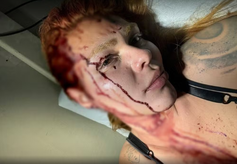 Travesti é agredida na ZL — Leste Online